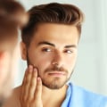 The Ultimate Guide to Combatting Oily Skin for Men
